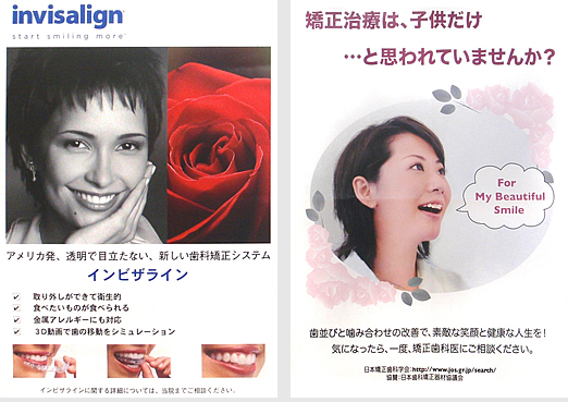 インビザライン